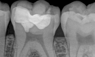 BioRepair-Case-Study-Blog-Banner.png BioRepair-Case-Study-Blog-Banner.png