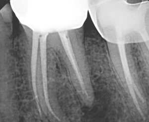 Case-Study-1-Pre-Op-1-2.png Case-Study-1-Pre-Op-1-2.png