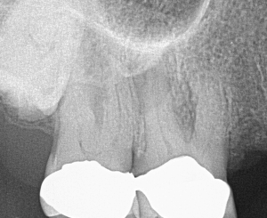 Case-Study-2-Pre-Op-1.png Case-Study-2-Pre-Op-1.png