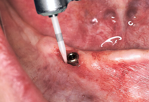 SURG_080805_02_KT_701_small-2.jpg SURG_080805_02_KT_701_small-2.jpg